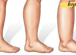 რა უნდა გააკეთოთ, თუ ფეხები შეგიშუპდათ?