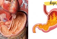 ეს მეთოდები დაგეხმარებათ შეინარჩუნოთ კუჭის ჯანმრთელობა!