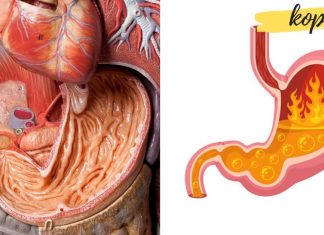 ეს მეთოდები დაგეხმარებათ შეინარჩუნოთ კუჭის ჯანმრთელობა!