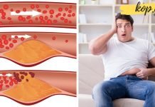 ზოგი რამ ქოლესტერინის შესახებ. თუ მაღალი ქოლესტერინი გაქვთ ეს უნდა გაითვალისწინოთ