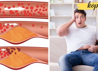 ზოგი რამ ქოლესტერინის შესახებ. თუ მაღალი ქოლესტერინი გაქვთ ეს უნდა გაითვალისწინოთ