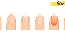 რას ამბობს თქვენი ფრჩხილები თქვენს ჯანმრთელობაზე?