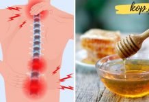 გამოიყენეთ თაფლი ართროზის სამკურნალოდ და დაემშვიდობეთ ტკივილს