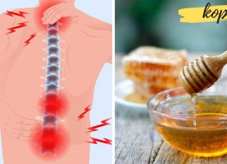 გამოიყენეთ თაფლი ართროზის სამკურნალოდ და დაემშვიდობეთ ტკივილს