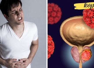 როგორ შეიძება ვიმკურნალოთ პროსტატაზე? ეს ბევრს დაეხმარა