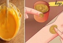 აი, ეს ძვირფასი სანელებელი დაგავიწყებთ სახსრების ტკივილს, გაგითეთრებთ კბილებსა და გაგისუფთავებთ სახის კანს.