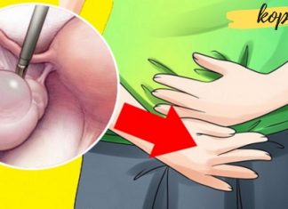 ეს საშუალებები დაგეხმარებათ საკვერცხის კისტის მოცილებაში