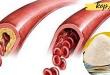 საუკეთესო წამალი ქოლესტერინისა და მაღალი არტერიული წნევის დროს! ამ სტატიის წაკითხვის შემდეგ, აღარასდროს მიიღებთ წამლებს!