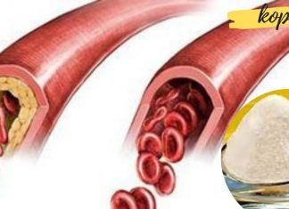 საუკეთესო წამალი ქოლესტერინისა და მაღალი არტერიული წნევის დროს! ამ სტატიის წაკითხვის შემდეგ, აღარასდროს მიიღებთ წამლებს!