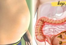 გაწუხებთ მუცლის შებერილობა? ამაში ეს ბუნებრივი საშუალებები დაგეხმარებათ