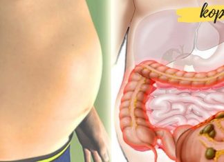 გაწუხებთ მუცლის შებერილობა? ამაში ეს ბუნებრივი საშუალებები დაგეხმარებათ