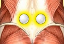 6 ყველაზე ეფექტური რჩევა ზურგის ტკივილის დროს. მარტივი ხერხებია