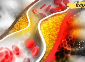 გაიწმინდეთ სისხლძარღვები კამით ვალერიანითა და თაფლით. ყველაზე ეფექტური მეთოდია რაც კი მიცდია