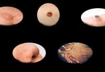 კანის პრობლემების გადაჭრის მარტივი და ბუნებრივი გზები. სასარგებლო ინფორმაციაა