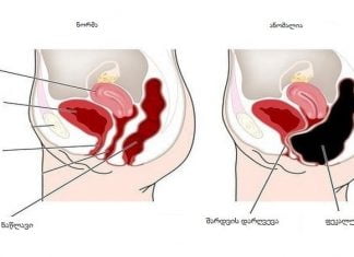 როგორ მოვიშოროთ მუცელი და დავივიწყოთ მუდმივი დისკომფორტის შესახებ? 5 სასარგებლო რჩევა