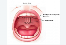 სად ვითარდება ორგანიზმში მოხვედრილი ვირუსი? ამის ცოდნა აუცილებლად გამოგადგებათ