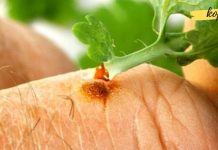 ქრისტესისხლა უფრო ეფექტურად მკურნალობს, ვიდრე ძვირადღირებული ფარმაცევტული პროდუქტები!!