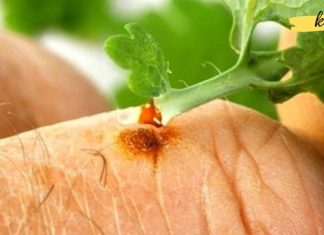 ქრისტესისხლა უფრო ეფექტურად მკურნალობს, ვიდრე ძვირადღირებული ფარმაცევტული პროდუქტები!!