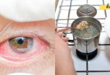 იტანჯებით გლაუკომით და თვალის პრობლემებით? – აქ მოცემულია რეცეპტები, რომლებიც ნამდვილად დაგეხმარებათ ამ პრობლემების მოგვარებაში!