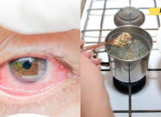 იტანჯებით გლაუკომით და თვალის პრობლემებით? – აქ მოცემულია რეცეპტები, რომლებიც ნამდვილად დაგეხმარებათ ამ პრობლემების მოგვარებაში!