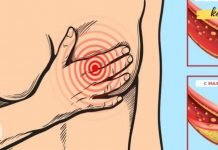 რატომ არის არტერიები დახურული და რა სასმელები ეხმარება მათ გაწმენდას?