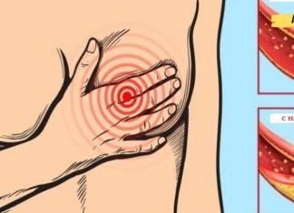 რატომ არის არტერიები დახურული და რა სასმელები ეხმარება მათ გაწმენდას?