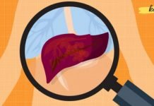 ღვიძლის პრობლემების თავიდან ასაცილებლად აუცილებელია გაითვალისწინოთ შემდეგი..