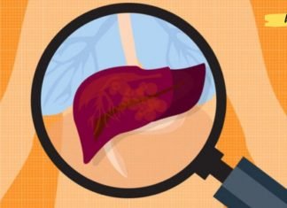 ღვიძლის პრობლემების თავიდან ასაცილებლად აუცილებელია გაითვალისწინოთ შემდეგი..