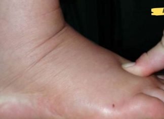 დაემშვიდობეთ სითხის შეკავებას, შეშუპებას და ჭარბ წონას მხოლოდ ერთ კვირაში ამ საოცარი რეცეპტით!