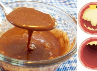 დაუჯერებელი საშუალებები, რომლებიც ხელს უშლიან გულის შეტევას, ამცირებენ ქოლესტერინს და აძლიერებენ თქვენს იმუნურ სისტემას!