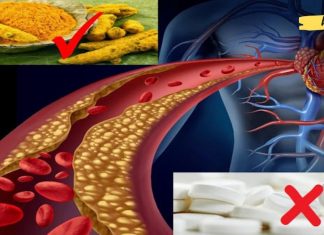 გულის დაავადების მქონე პაციენტებს შეუძლიათ ასპირინის ნაცვლად კურკუმა გამოიყენონ