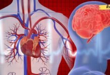 ინსულტი და გულის შეტევა: რა განსხვავებაა მათ შორის? ეს უნდა იცოდეთ