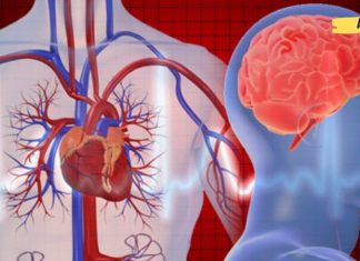 ინსულტი და გულის შეტევა: რა განსხვავებაა მათ შორის? ეს უნდა იცოდეთ
