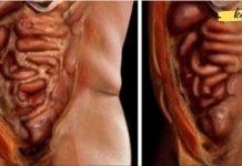 უბრალოდ გამოიყენეთ ეს 2 ინგრედიენტი თქვენი სხეულიდან ცხიმისა და პარაზიტების მოსაცილებლად!