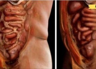 უბრალოდ გამოიყენეთ ეს 2 ინგრედიენტი თქვენი სხეულიდან ცხიმისა და პარაზიტების მოსაცილებლად!