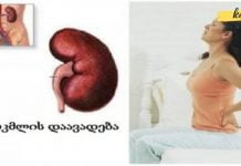 სიმპტომები, რომლებიც თირკმლის დაავადებაზე მეტყველებს. საჭირო ინფორმაციაა