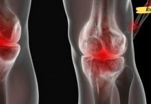 პირველი დახმარება სახსრების ტკივილის დროს