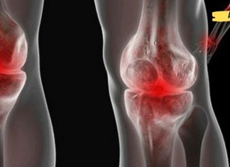 პირველი დახმარება სახსრების ტკივილის დროს