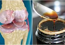 პროდუქტი, რომელიც აძლიერებს სახსრებსა და ძვლებს ბუნებრივი ინგრედიენტების დახმარებით!