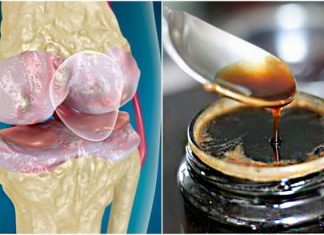 პროდუქტი, რომელიც აძლიერებს სახსრებსა და ძვლებს ბუნებრივი ინგრედიენტების დახმარებით!