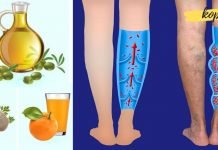 თუ ვენების გაფართოება გაწუხებთ, ეს საშუალება უნდა გამოიყენოთ