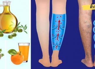 თუ ვენების გაფართოება გაწუხებთ, ეს საშუალება უნდა გამოიყენოთ