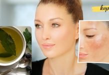 როგორ მოვიშოროთ პიგმენტური ლაქები სახლის პირობებში? ეს ძალიან მარტივია!!.