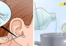 2 ინგრედიენტის ნაზავი ყურის ცვილის მოსაშორებლად და ინფექციების სამკურნალოდ