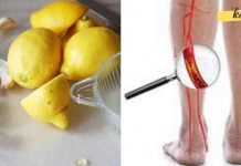 ლიმონისა და ნიორის შესანიშნავი კომბინაცია დაგეხმარებათ არტერიების გაწენდაში და აგაცილებთ გულის შეტევებს.