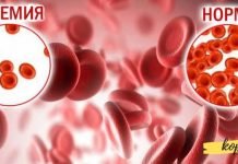 რა ხდება სხეულში, როდესაც რკინის დონე დაბალია? ყურადსაღები ინფორმაციაა