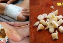 ფანტასტიკური დეტოქსიკაცია: თქვენ შეგიძლიათ მოიშოროთ ტოქსინები ძილის დროს!