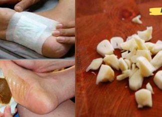 ფანტასტიკური დეტოქსიკაცია: თქვენ შეგიძლიათ მოიშოროთ ტოქსინები ძილის დროს!