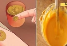 ეს რეცეფტი შეგიმსუბუქებთ სახსრების ტკივილს