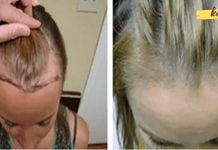 ალბათ ეს მცენარე თქვენს ბაღში იზრდება, მაგრამ თქვენ არ იცოდით, რომ მას შეუძლია სიმელოტისა და რევმატიზმის განკურნება!